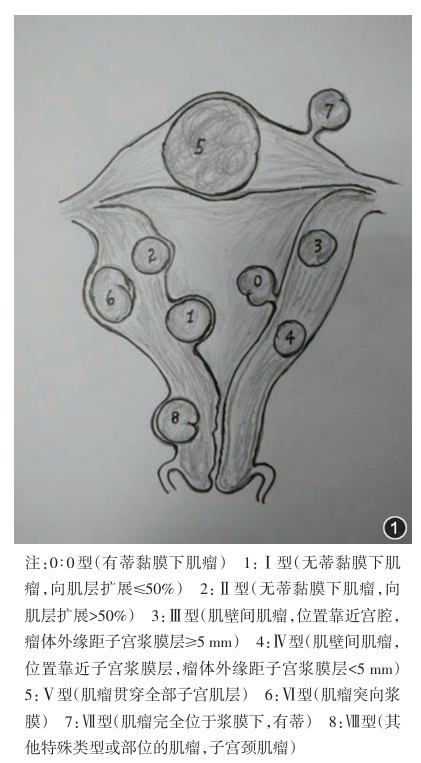 图1 分类